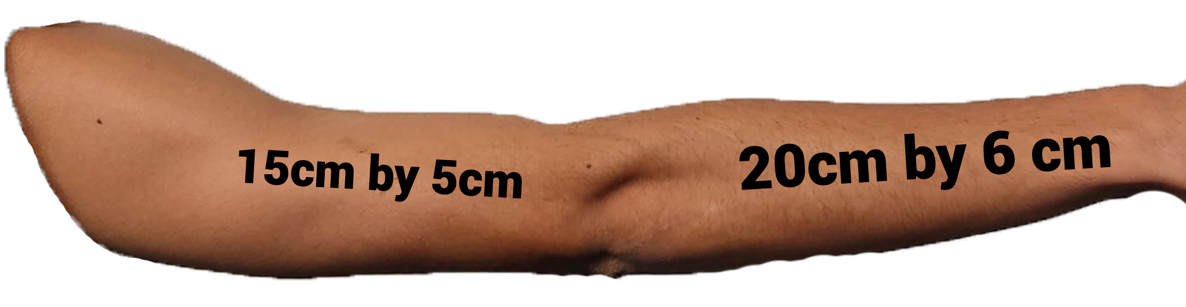 arm 15 by 5 and 20 by 6